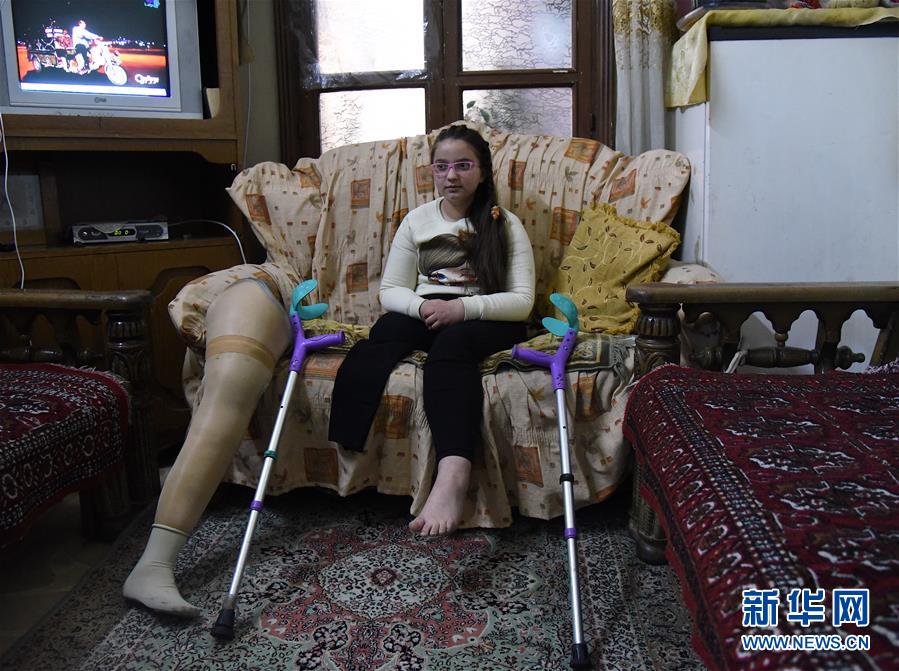 （國際·圖文互動）（1）通訊：戰爭給他們留下殘缺的童年——敘利亞危機9周年記